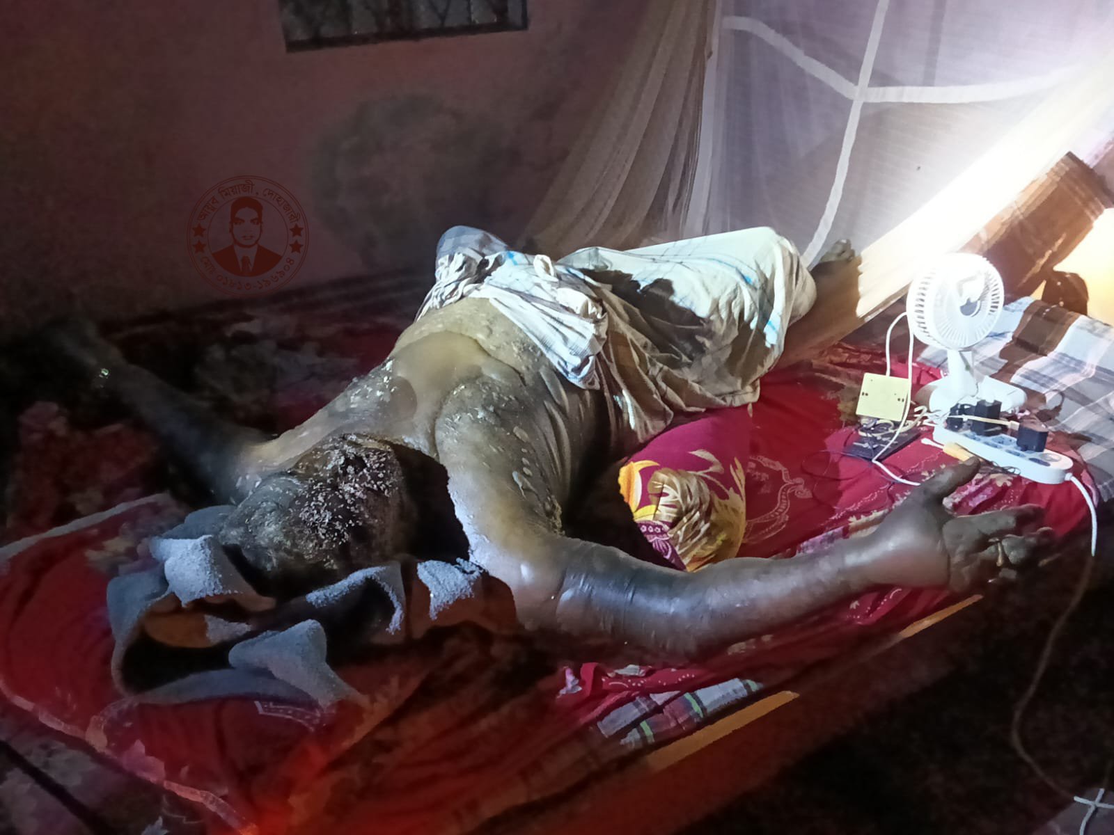 চন্দনাইশে বৃদ্ধের মরদেহ উদ্ধার, নিঃসঙ্গ জীবনের করুণ পরিণতি